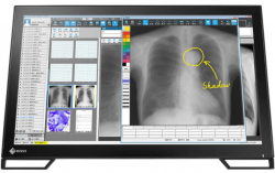 Monitor EIZO RadiForce MS236WT-A